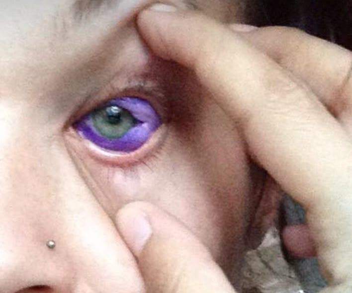 Esta Mujer Decidió Tatuarse La Esclerótica Del Ojo Y El Resultado Es Tan Desagradable Como Te